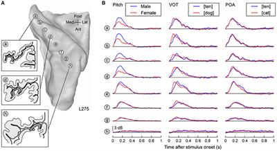 Differential activation of human core, non-core and auditory-related cortex during speech categorization tasks as revealed by intracranial recordings